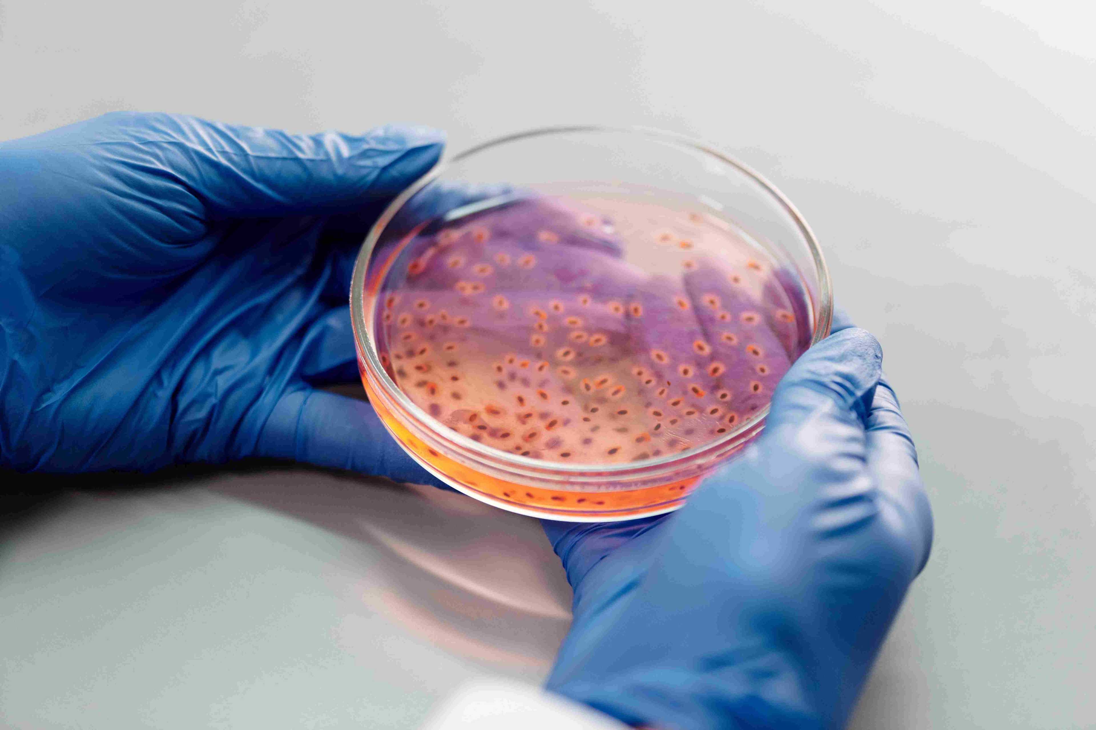 Metagenomic Analysis (Shotgun method)